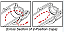 Cross Section of 2-Position Caps